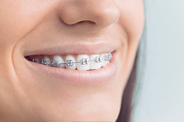Best Invisalign and Clear Aligners  in Arlington, TN